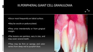III.PERIPHERAL GIANT CELL GRANULOMA
Occur most frequently on labial surface.
May be sessile or pedunculated.
They arise interdentally or from gingival
margin.
The lesions are painless, vary in size, and
may cover several teeth.
They may be firm or spongy and color
varies from deep red to purplish blue.
 