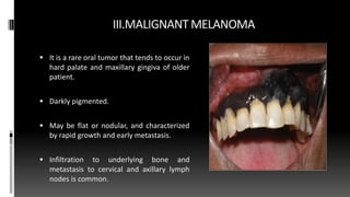 III.MALIGNANT MELANOMA
 It is a rare oral tumor that tends to occur in
hard palate and maxillary gingiva of older
patient.
 Darkly pigmented.
 May be flat or nodular, and characterized
by rapid growth and early metastasis.
 Infiltration to underlying bone and
metastasis to cervical and axillary lymph
nodes is common.
 