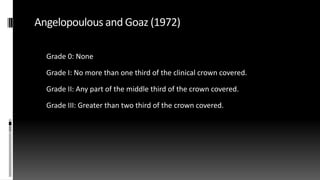 Angelopoulous and Goaz (1972)
Grade 0: None
Grade I: No more than one third of the clinical crown covered.
Grade II: Any part of the middle third of the crown covered.
Grade III: Greater than two third of the crown covered.
 