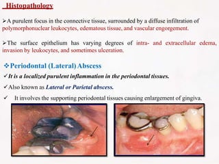 Histopathology
A purulent focus in the connective tissue, surrounded by a diffuse infiltration of
polymorphonuclear leukocytes, edematous tissue, and vascular engorgement.
The surface epithelium has varying degrees of intra- and extracellular edema,
invasion by leukocytes, and sometimes ulceration.
Periodontal (Lateral)Abscess
It is a localized purulent inflammation in the periodontal tissues.
Also known as Lateral or Parietal abscess.
 It involves the supporting periodontal tissues causing enlargement of gingiva.
 