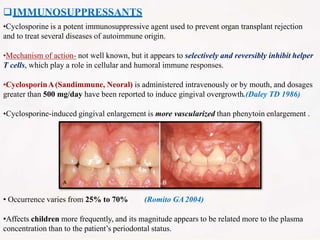 IMMUNOSUPPRESSANTS
•Cyclosporine is a potent immunosuppressive agent used to prevent organ transplant rejection
and to treat several diseases of autoimmune origin.
•Mechanism of action- not well known, but it appears to selectively and reversibly inhibit helper
T cells, which play a role in cellular and humoral immune responses.
•CyclosporinA(Sandimmune, Neoral) is administered intravenously or by mouth, and dosages
greater than 500 mg/day have been reported to induce gingival overgrowth.(Daley TD 1986)
•Cyclosporine-induced gingival enlargement is more vascularized than phenytoin enlargement .
• Occurrence varies from 25% to 70% (Romito GA2004)
•Affects children more frequently, and its magnitude appears to be related more to the plasma
concentration than to the patient’s periodontal status.
 