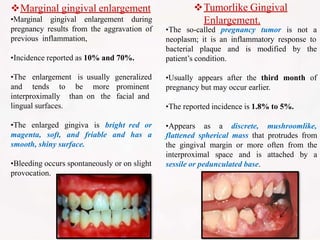 Marginal gingival enlargement
•Marginal gingival enlargement during
pregnancy results from the aggravation of
previous inflammation,
•Incidence reported as 10% and 70%.
usually
more
on the
generalized
prominent
facial and
•The enlargement is
and tends to be
interproximally than
lingual surfaces.
red or
has a
•The enlarged gingiva is bright
magenta, soft, and friable and
smooth, shiny surface.
•Bleeding occurs spontaneously or on slight
provocation.
Tumorlike Gingival
Enlargement.
•The so-called pregnancy tumor is not a
neoplasm; it is an inflammatory response to
bacterial plaque and is modified by the
patient’s condition.
•Usually appears after the third month of
pregnancy but may occur earlier.
•The reported incidence is 1.8% to 5%.
•Appears as a discrete, mushroomlike,
flattened spherical mass that protrudes from
the gingival margin or more often from the
interproximal space and is attached by a
sessile or pedunculated base.
 