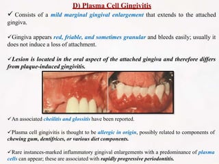 D) Plasma Cell Gingivitis
 Consists of a mild marginal gingival enlargement that extends to the attached
gingiva.
Gingiva appears red, friable, and sometimes granular and bleeds easily; usually it
does not induce a loss of attachment.
Lesion is located in the oral aspect of the attached gingiva and therefore differs
from plaque-induced gingivitis.
An associated cheilitis and glossitis have been reported.
Plasma cell gingivitis is thought to be allergic in origin, possibly related to components of
chewing gum, dentifrices, or various diet components.
Rare instances-marked inflammatory gingival enlargements with a predominance of plasma
cells can appear; these are associated with rapidly progressive periodontitis.
 