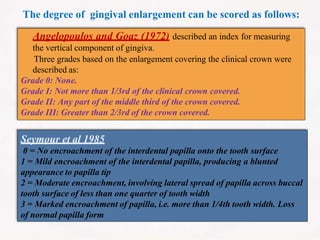 The degree of gingival enlargement can be scored as follows:
Angelopoulos and Goaz (1972) described an index for measuring
the vertical component of gingiva.
Three grades based on the enlargement covering the clinical crown were
described as:
Grade 0: None.
Grade I: Not more than 1/3rd of the clinical crown covered.
Grade II: Any part of the middle third of the crown covered.
Grade III: Greater than 2/3rd of the crown covered.
Seymour et al 1985
0 = No encroachment of the interdental papilla onto the tooth surface
1 = Mild encroachment of the interdental papilla, producing a blunted
appearance to papilla tip
2 = Moderate encroachment, involving lateral spread of papilla across buccal
tooth surface of less than one quarter of tooth width
3 = Marked encroachment of papilla, i.e. more than 1/4th tooth width. Loss
of normal papilla form
 