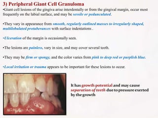 3) Peripheral Giant Cell Granuloma
•Giant cell lesions of the gingiva arise interdentally or from the gingival margin, occur most
frequently on the labial surface, and may be sessile or pedunculated.
•They vary in appearance from smooth, regularly outlined masses to irregularly shaped,
multilobulated protuberances with surface indentations .
•Ulceration of the margin is occasionally seen.
•The lesions are painless, vary in size, and may cover several teeth.
•They may be firm or spongy, and the color varies from pink to deep red or purplish blue.
•Local irritation or trauma appears to be important for these lesions to occur.
It has growth potential and may cause
separation of teeth duetopressureexerted
by thegrowth
 