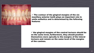 10
 The contour of the gingival margins of the six
maxillary anterior teeth plays an important role in
smile esthetics and is determined by the following
features
 the gingival margins of the central incisors should be
on the same level, furthermore, they should position
themselves more apically to the margins of the lateral
incisors and remain on the same level of the margins
of the canines.
 