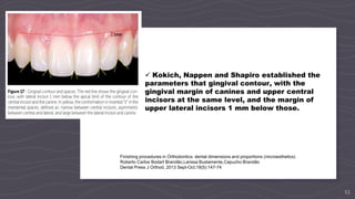 12
Finishing procedures in Orthodontics: dental dimensions and proportions (microesthetics)
Roberto Carlos Bodart Brandão,Larissa Bustamente,Capucho Brandão
Dental Press J Orthod. 2013 Sept-Oct;18(5):147-74
 Kokich, Nappen and Shapiro established the
parameters that gingival contour, with the
gingival margin of canines and upper central
incisors at the same level, and the margin of
upper lateral incisors 1 mm below those.
 