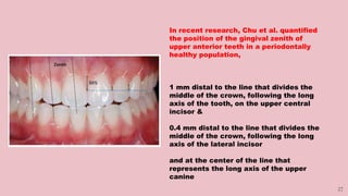 27
In recent research, Chu et al. quantified
the position of the gingival zenith of
upper anterior teeth in a periodontally
healthy population,
1 mm distal to the line that divides the
middle of the crown, following the long
axis of the tooth, on the upper central
incisor &
0.4 mm distal to the line that divides the
middle of the crown, following the long
axis of the lateral incisor
and at the center of the line that
represents the long axis of the upper
canine
 