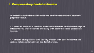 32
1. Compensatory dental extrusion
Compensatory dental extrusion is one of the conditions that alter the
gingival contour.
 It tends to occur as a result of wear and/or fracture of the incisal edge of
anterior teeth, which extrude and carry with them the entire periodontal
tissues.
 It affects adult patients who usually present with poor horizontal and
vertical relationship between the dental arches.
 