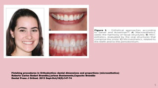 5
Finishing procedures in Orthodontics: dental dimensions and proportions (microesthetics)
Roberto Carlos Bodart Brandão,Larissa Bustamente,Capucho Brandão
Dental Press J Orthod. 2013 Sept-Oct;18(5):147-74
 