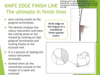 Gingival finish lines in fixed prosthodontics | PPT