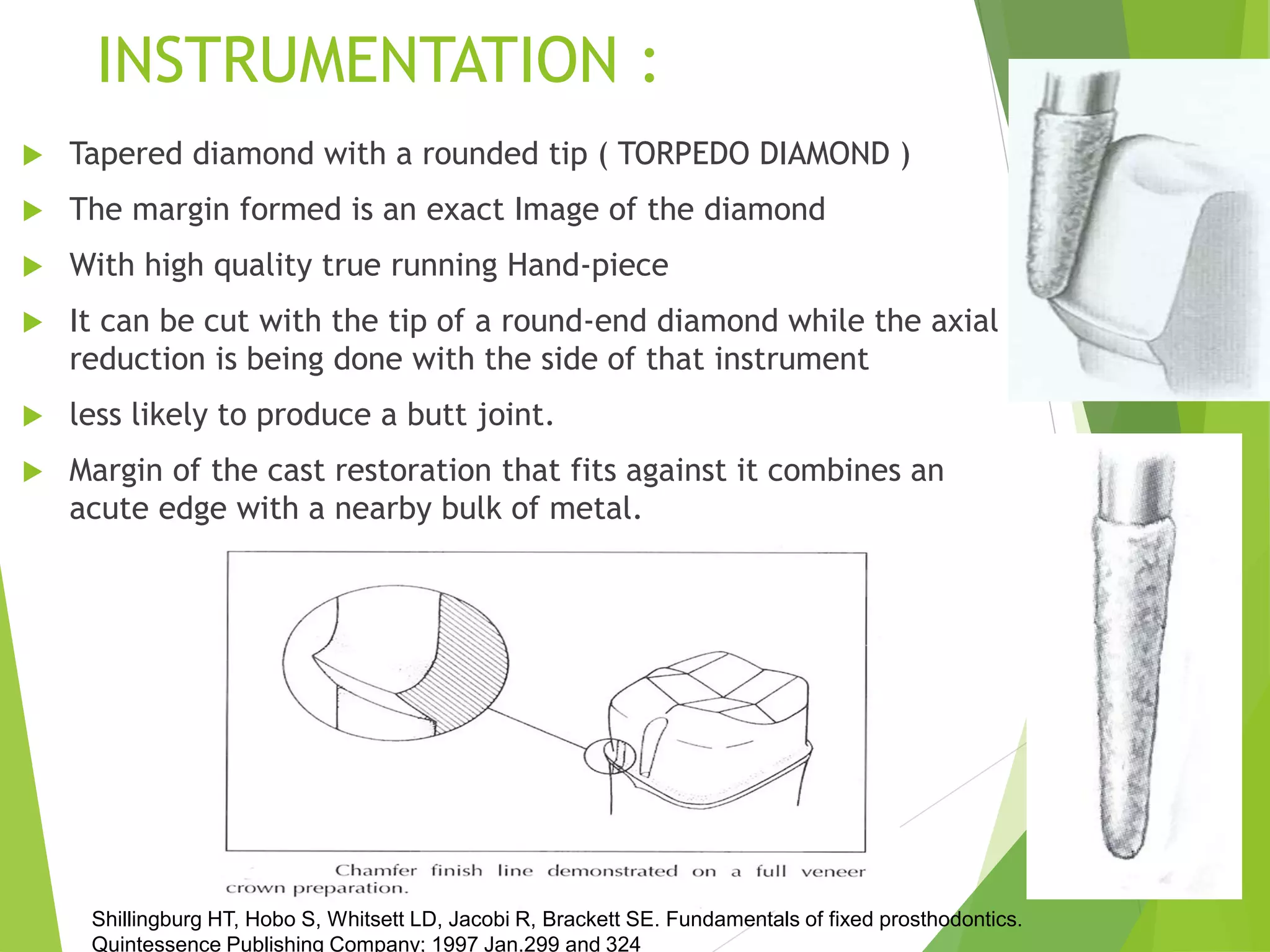 Gingival finish lines in fixed partial denture(FPD) with references PPT