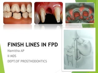 FINISH LINES IN FPD
Namitha AP
II MDS
DEPT.OF PROSTHODONTICS
 