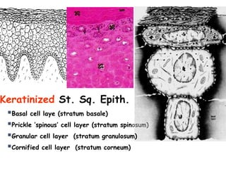 Keratinized St. Sq. Epith.
▪Basal cell laye (stratum basale)
▪Prickle ’spinous’ cell layer (stratum spinosum)
▪Granular cell layer (stratum granulosum)
▪Cornified cell layer (stratum corneum)
 