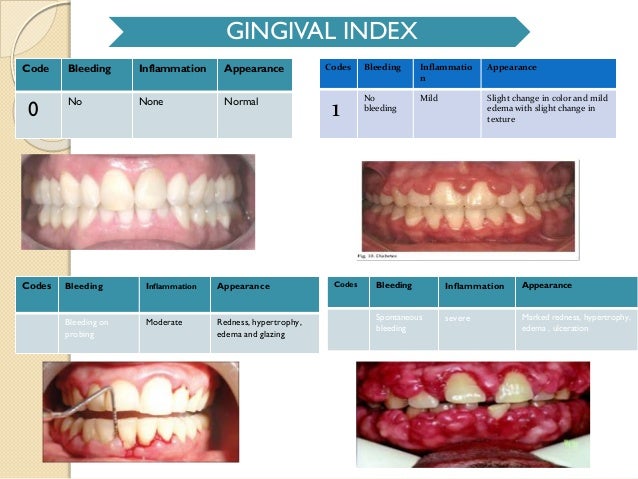 Gingival indexs