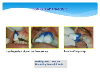 Comprecap Instructions Gingival tissue management | PPTX