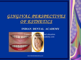 GINGIVAL PERSPECTIVES
OF ESTHETICS
INDIAN DENTAL ACADEMY
Leader in continuing dental education
www.indiandentalacademy.com
www.indiandentalacademy.com
 