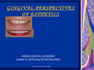 GINGIVAL PERSPECTIVES
OF ESTHETICS
INDIAN DENTAL ACADEMY
Leader in continuing Dental Education
www.indiandentalacademy.com
 
