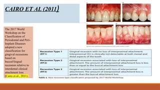 Gingival recession.pptx in department of Periodontology | PPTX