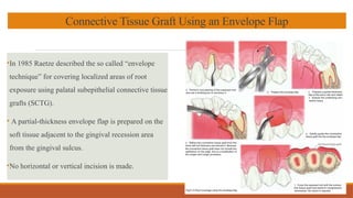 Gingival recession.pptx in department of Periodontology | PPTX