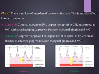 Gingival recession aries | PPTX