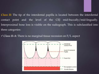 Gingival recession aries | PPTX