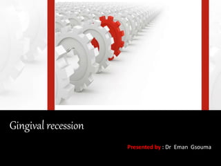 Gingival recession
Presented by : Dr Eman Gsouma
 