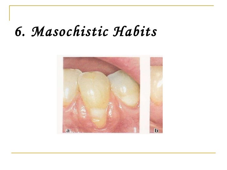gingival recession