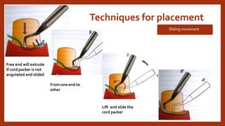 Techniques for placement
Sliding movement
Free end will extrude
if cord packer is not
angulated and slided
From one end to
other
Lift and slide the
cord packer
 