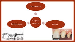 Surgical
methods
Gingivectomy
Rotary
Electrosurgery
 