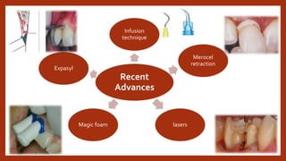 Recent
Advances
Infusion
technique
Merocel
retraction
lasers
Magic foam
Expasyl
 