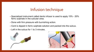 Infusion technique
• Specialized instrument called dento infusor is used to apply 15% - 20%
ferric sulphate in the sulcular area.
• Done with firm pressure with burnishing action.
• Cord is dipped in ferric sulphate solution and packed into the sulcus.
• Left in the sulcus for 1 to 3 minutes.
 