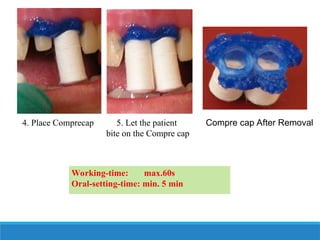 Comprecap Instructions GINGIVAL RETRACTION in fixed prosthodontics | PPT