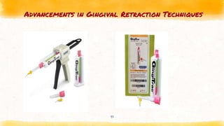 Advancements in Gingival Retraction Techniques
41
 