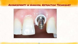 Advancements in Gingival Retraction Techniques
46
 