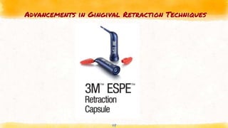 Advancements in Gingival Retraction Techniques
48
 
