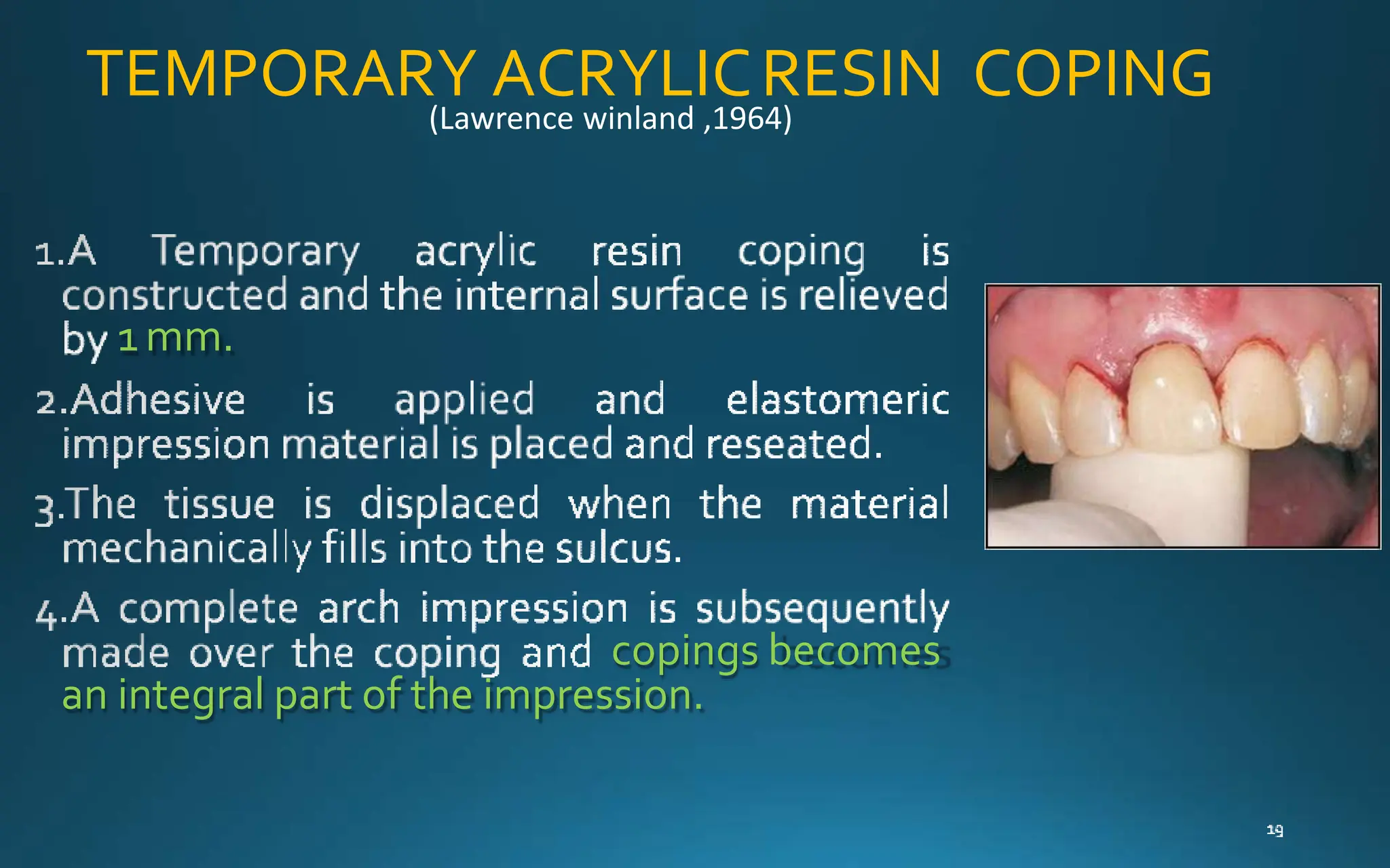 TEMPORARY ACRYLICRESIN COPING
1 mm.
copings becomes
an integral part of the impression.
(Lawrence winland ,1964)
 