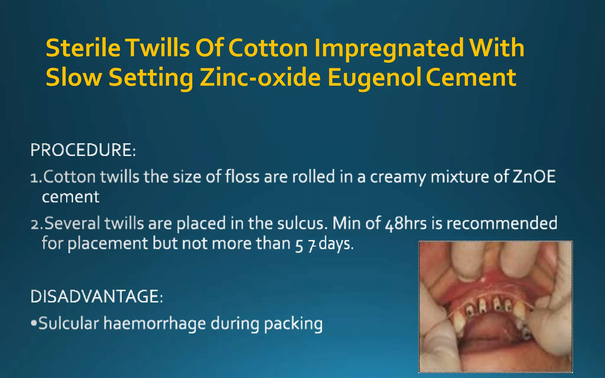 SterileTwills Of Cotton ImpregnatedWith
Slow Setting Zinc-oxide EugenolCement
-
 