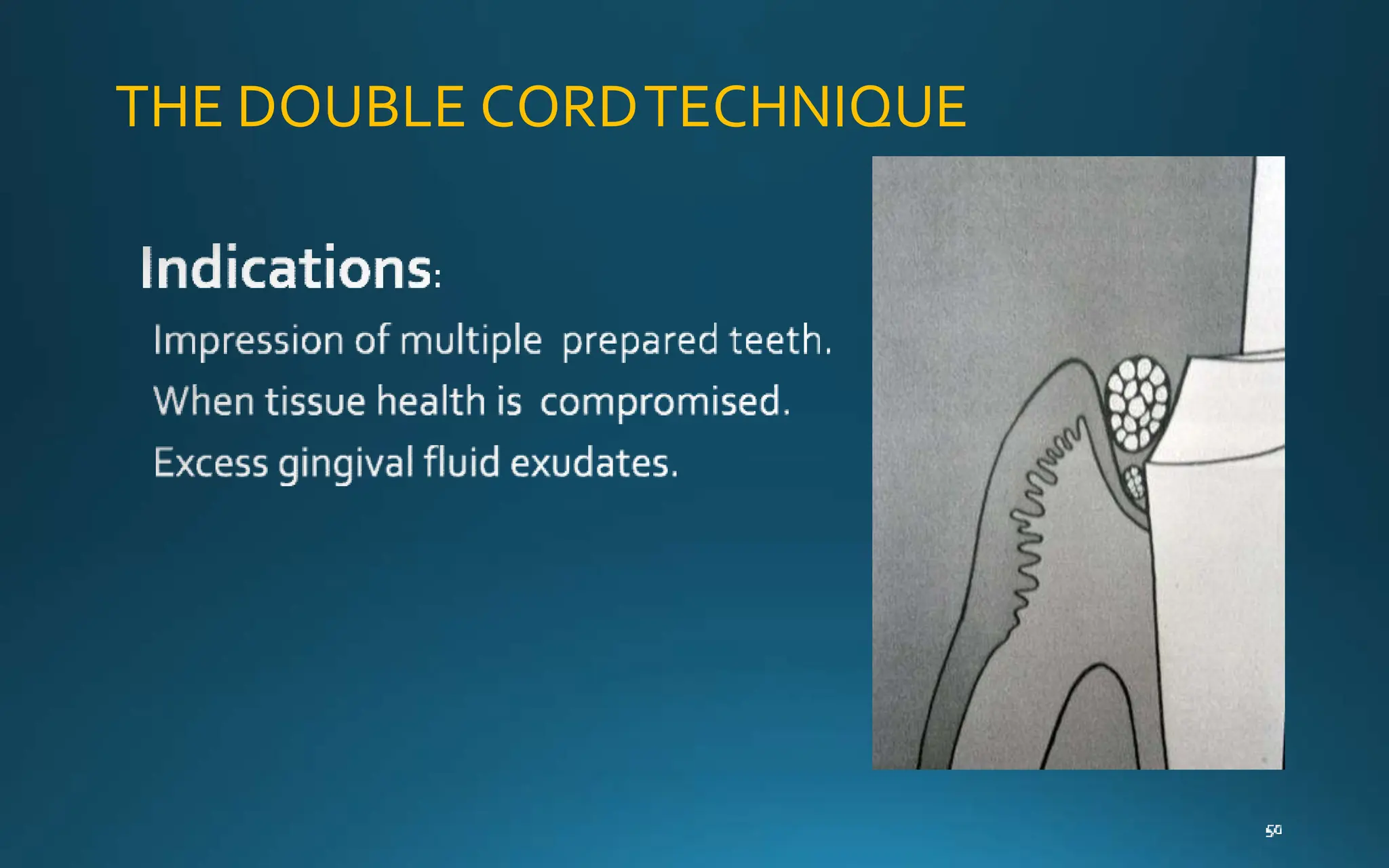 THE DOUBLE CORDTECHNIQUE
 
