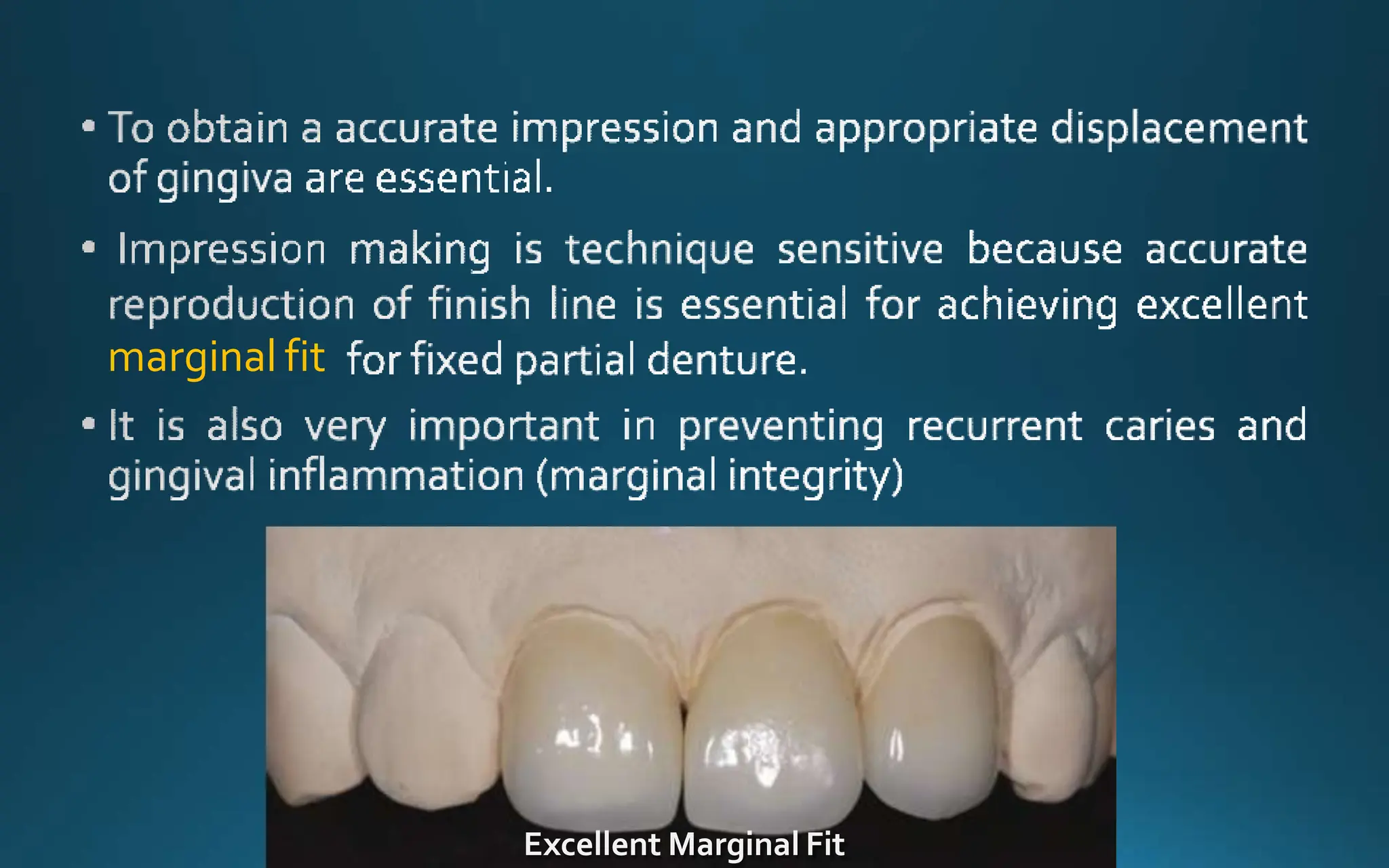 marginal fit
Excellent Marginal Fit
 