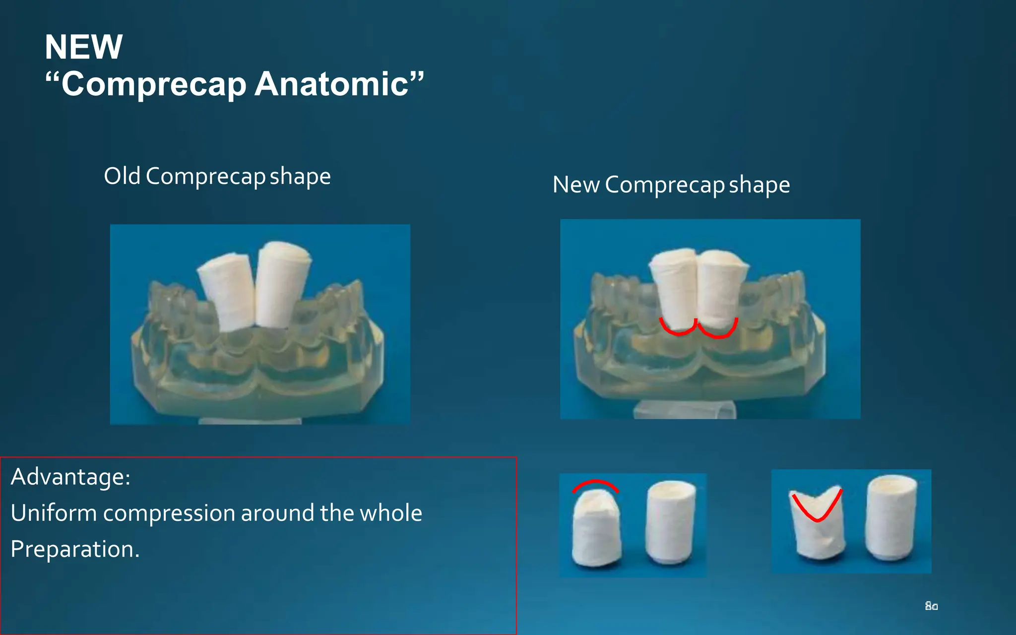 NEW
“Comprecap Anatomic”
Old Comprecapshape New Comprecapshape
Advantage:
Uniform compression around the whole
Preparation.
 