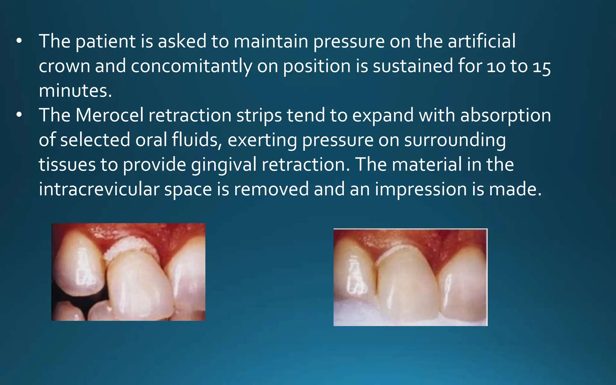 • The patient is asked to maintain pressure on the artificial
crown and concomitantly on position is sustained for 10 to 15
minutes.
• The Merocel retraction strips tend to expand with absorption
of selected oral fluids, exerting pressure on surrounding
tissues to provide gingival retraction. The material in the
intracrevicular space is removed and an impression is made.
 