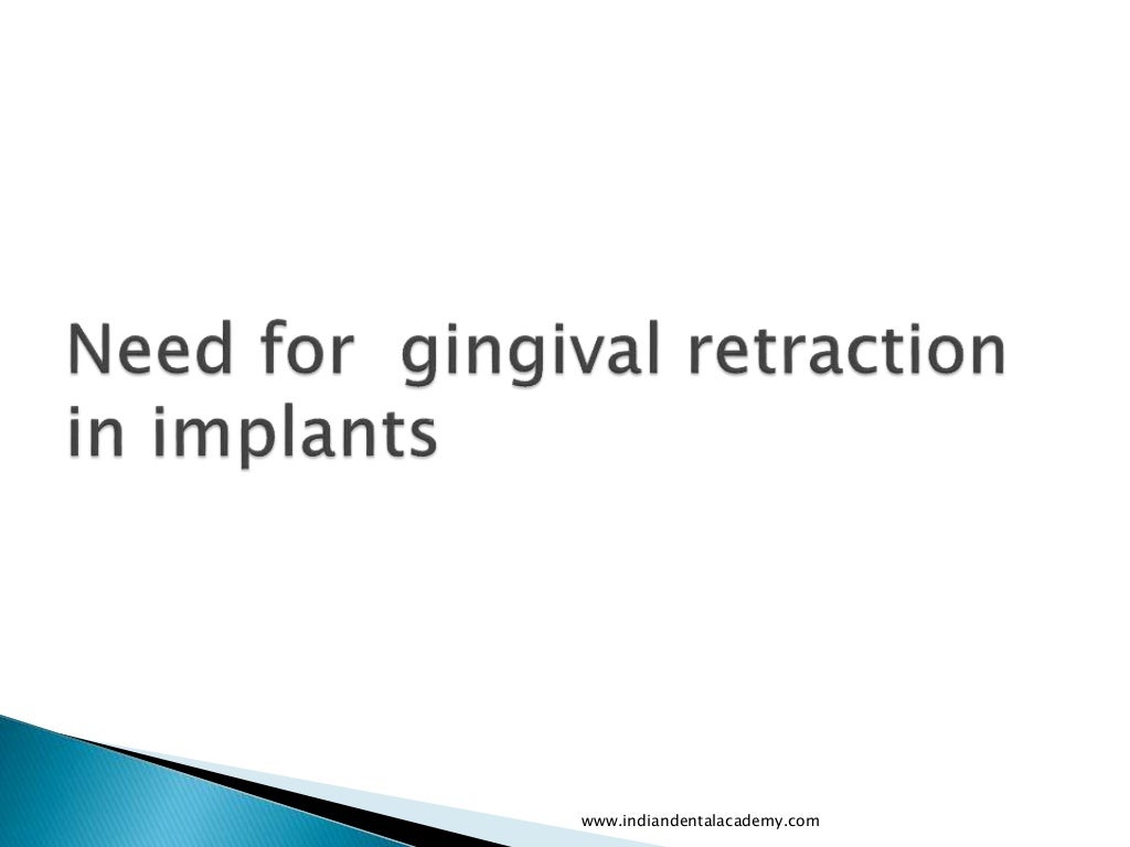 Gingival retraction techniques for implants versus teeth/ cosmetic de…