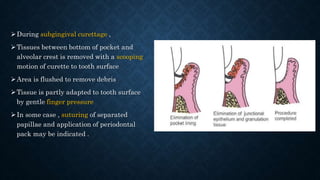 During subgingival curettage ,
Tissues between bottom of pocket and
alveolar crest is removed with a scooping
motion of curette to tooth surface
Area is flushed to remove debris
Tissue is partly adapted to tooth surface
by gentle finger pressure
In some case , suturing of separated
papillae and application of periodontal
pack may be indicated .
 