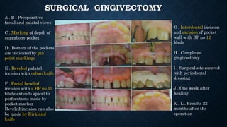 Gingival surgical procedures | PPTX