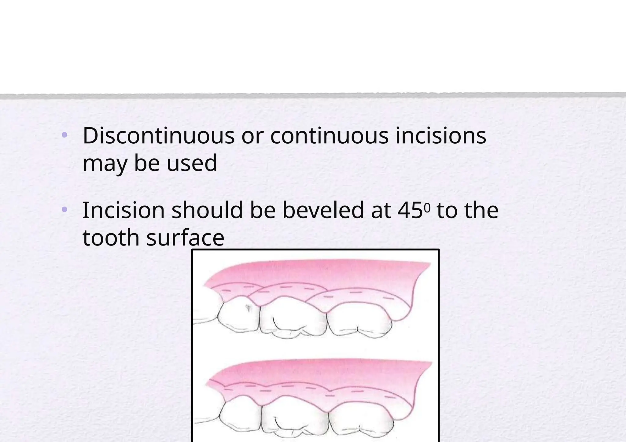 Gingival surgical techniques-Dr Deepthi.pptx