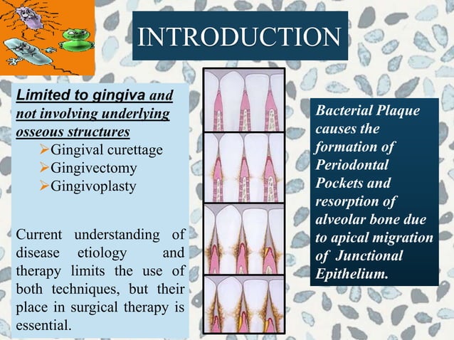 GINGIVAL SURGICAL TECHNIQUES IN PERIODONTOLOGY | PPTX | Dental Health ...