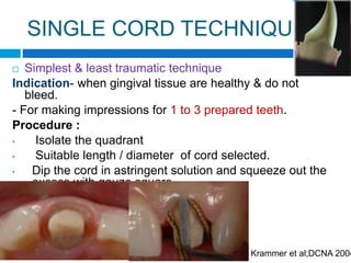 Gingival tissue displacement in fpd | PPTX