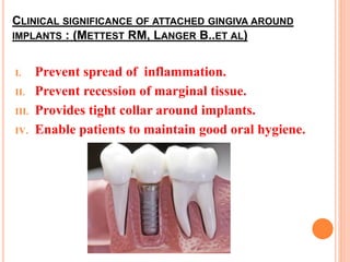 CLINICAL SIGNIFICANCE OF ATTACHED GINGIVA AROUND
IMPLANTS : (METTEST RM, LANGER B..ET AL)
I. Prevent spread of inflammation.
II. Prevent recession of marginal tissue.
III. Provides tight collar around implants.
IV. Enable patients to maintain good oral hygiene.
 