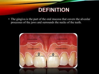 • The gingiva is the part of the oral mucosa that covers the alveolar
processes of the jaws and surrounds the necks of the teeth.
 